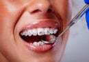 A Parent’s Guide to Halloween Candy and Braces