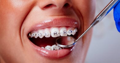 A Parent’s Guide to Halloween Candy and Braces